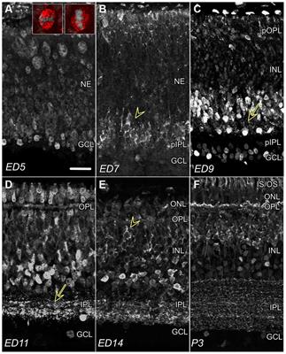 Temporal and Isoform-Specific Expression of CTBP2 Is Evolutionarily Conserved Between the Developing Chick and Human Retina